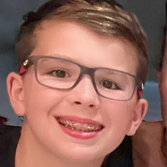 Modern boy smiling with braces at Camp One Step, a supportive summer camp for kids with cancer.